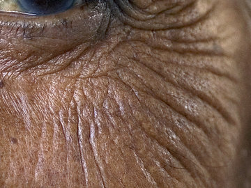 Трихолог Егорова: избавиться от морщин сна помогает утренняя зарядка