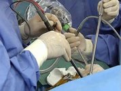 Вернуть стабильность: российские вертебрологи учатся