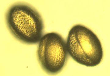 Иммунолог Жоголева: стресс обостряет состояние при аллергии