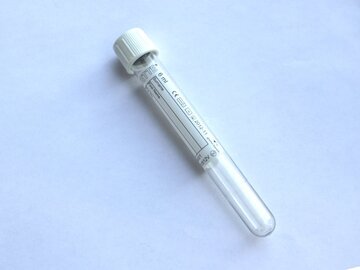 Врач Карасев: снижение эритроцитов указывает на инфекцию