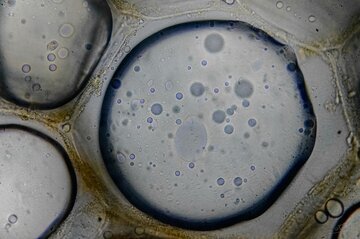 Уролог Богатырев: термобелье снижает подвижность сперматозоидов