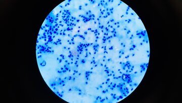 Conversation: качество сперматозоидов падает с 20 лет