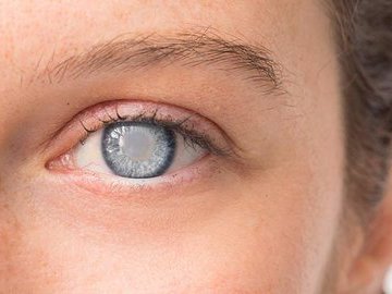 Проблемы со зрением после 40 лет: катаракта, глаукома и другие