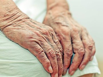 Как предотвратить быстрое старение кожи рук