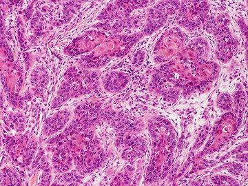 Доктор Айч: микробиом кишечника способен предотвратить диабет