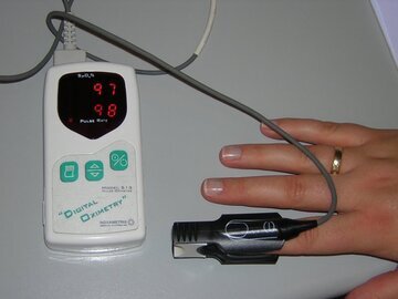 Врач Малышева: женщинам до 39 лет нужно сделать ЭКГ