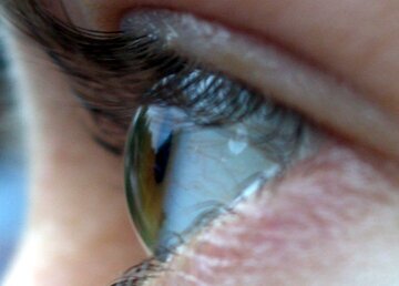 Врач Филатов: молнии перед глазами требуют срочного осмотра