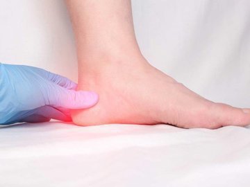 Боль в пятке? 5 возможных причин