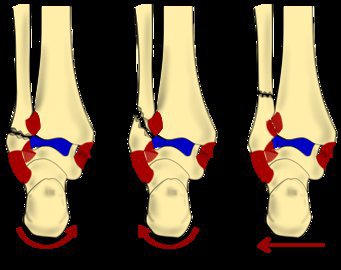 Врач Галкин: при болезнях печени появляется боль в суставах