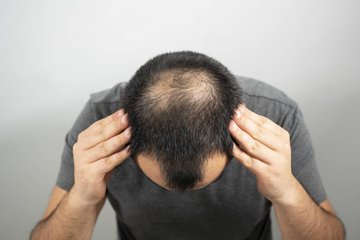 Найдены стволовые клетки для регенерации волос