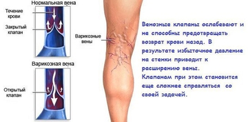 Берем ножки под защиту
