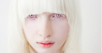 Что такое альбинизм?