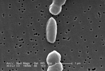 Врач Уланкина: бутилированная вода спасет от заражения бактериями Vibrio
