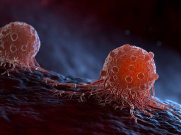 Что помогает предотвратить рак – какие-то продукты или изменение образа жизни?