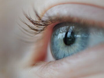 Дерматолог Ужва: в мешках под глазами виноваты почки