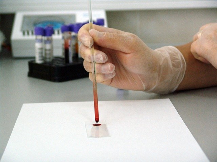 Доктор Мясников дал советы по подготовке к анализу крови