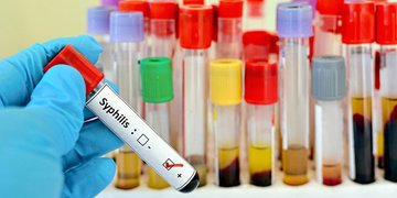 Анализы крови, мазок, поясничная пункция и другие методы диагностики сифилиса