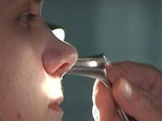 Хирургический лазер против носового платка