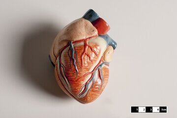 ПГУ: риск фиброза миокарда у женщин после 50 лет выше