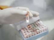 Тест на диабет: бесплатно и без очереди