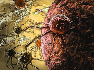 Иммунотерапия - как спасение от рака