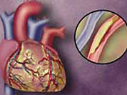 Диагностика сердца: молекулярный уровень