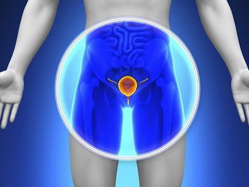 Мужчины, берегите себя! или Рак простаты, который излечим